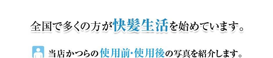 全国で多くの方が、快髪生活始めています。当店かつらの使用前使用後の写真を紹介します。