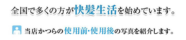 全国で多くの方が、快髪生活始めています。当店かつらの使用前使用後の写真を紹介します。