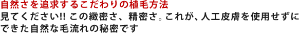 自然さを追求するこだわりの植毛方法 見てください!! この緻密さ、精密さ。これが、人工皮膚を使用せずにできた自然な毛流れの秘密です