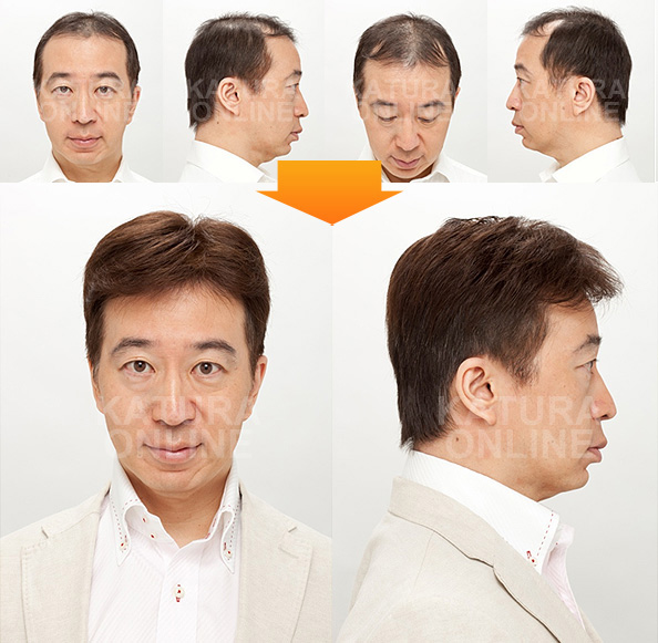オーダーかつらの使用前 使用後 No 3 40代 かつら カツラ の男性 女性用通販なら かつらオンライン オーダーかつらの使用前 使用後 No 3 40代 かつら カツラ の男性 女性用通販なら かつらオンライン