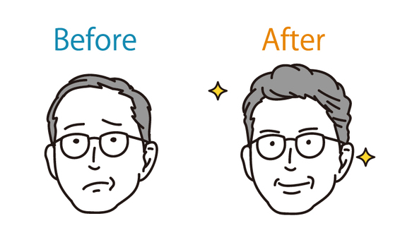 かつらの使用前・使用後