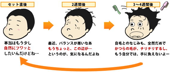 かつらが上手くいかないケース