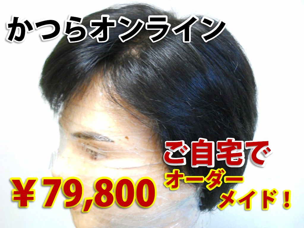 かつらオンラインの医療用かつら