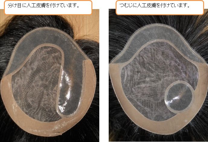 つむじや分け目に人工皮膚を付けています