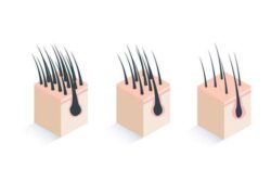 かつらの毛量はどこまで減らせるか?